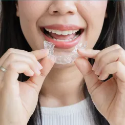 Invisalign at Joobbani Dental Designs in Columbia, Maryland