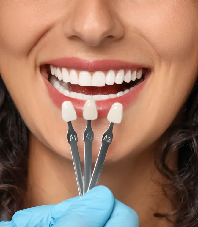 Dental Veneers at Joobbani Dental Designs in Columbia, Maryland
